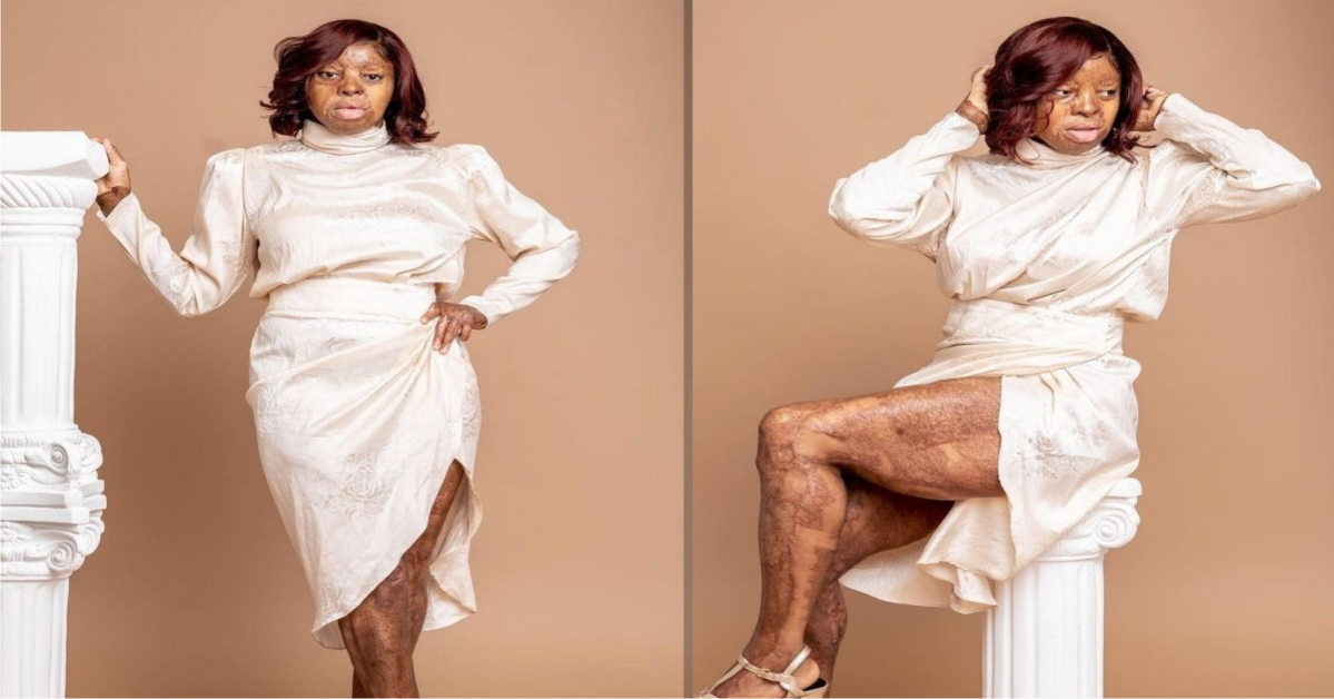 Singer, Kechi Okwuchi Shows Off Her Legs In Recent Photos (PHOTOS)