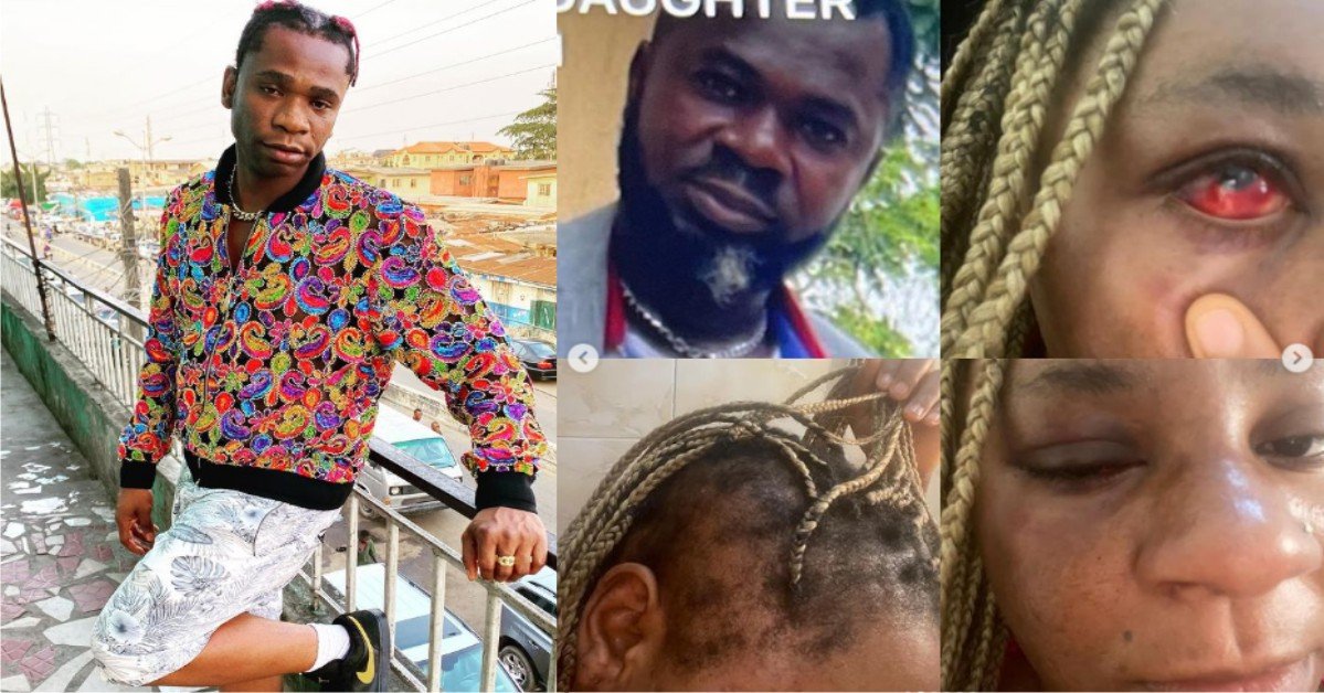 Speed Darlington's Sister Physically Assaulted By Her Husband