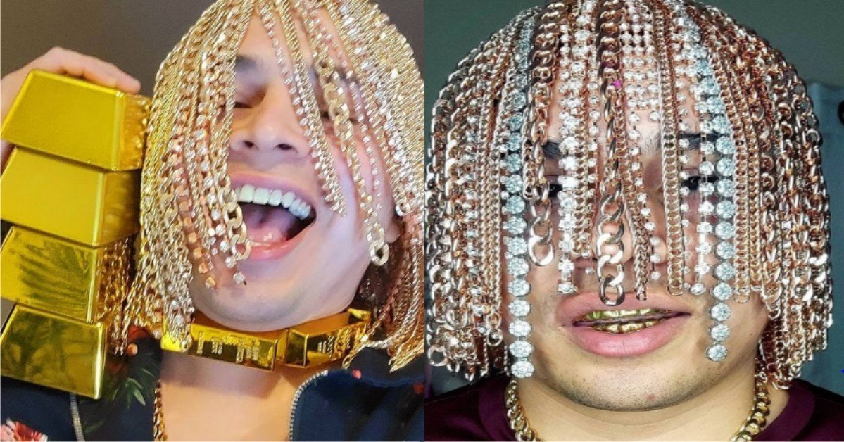 PHOTOS: Rapper Dan Sur Gets Gold Chains Surgically Implanted Into His Head