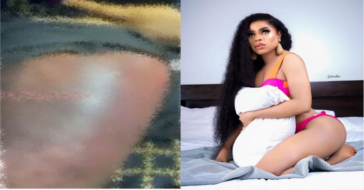 Leaked Video Of Bobrisky’s Alleged ‘Infected’ Butt Surgery Hits The Net
