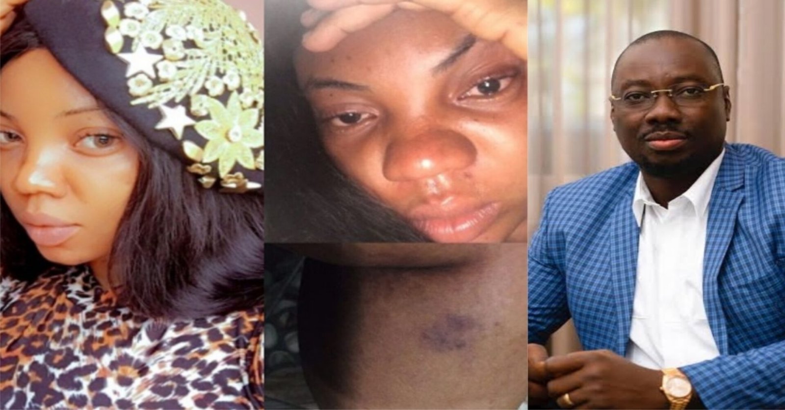 Days After His Release, Lady Calls Out Obi Cubana After Receiving Beating Of Her Life