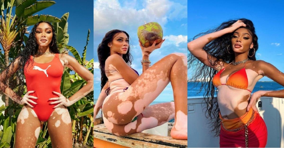 Jamaican Supermodel, Winnie Harlow Drops New Snazzy Photos On IG