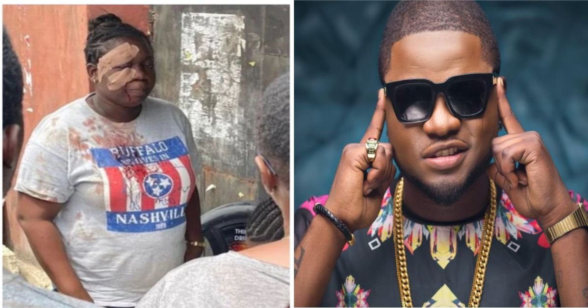 "This is my Here" - Skales Hails Bina Jennifer For Coming Back To Her Polling Unit to Vote After Thugs Injured Her